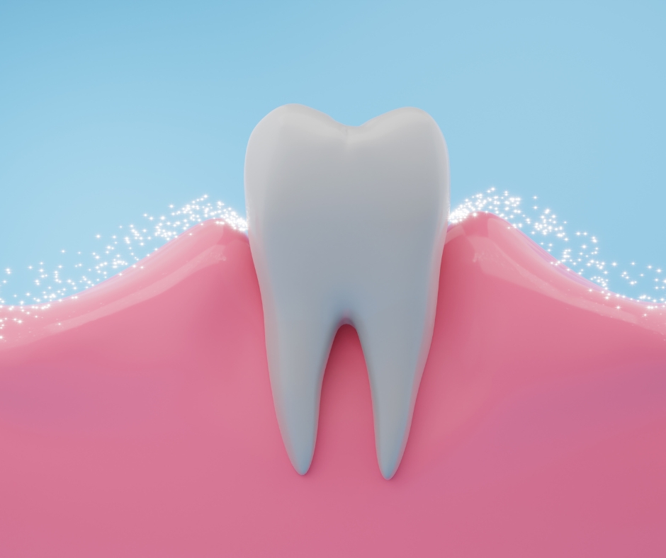 Single Tooth Implant Cost UK